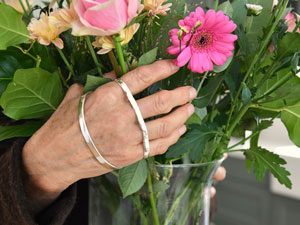 Silver splint example 3